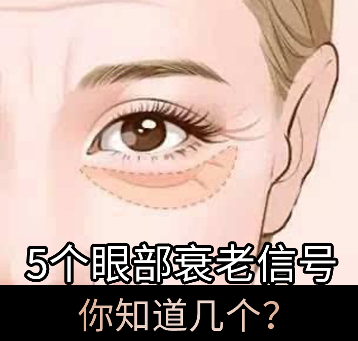 5個眼部衰老信號，你知道幾個？