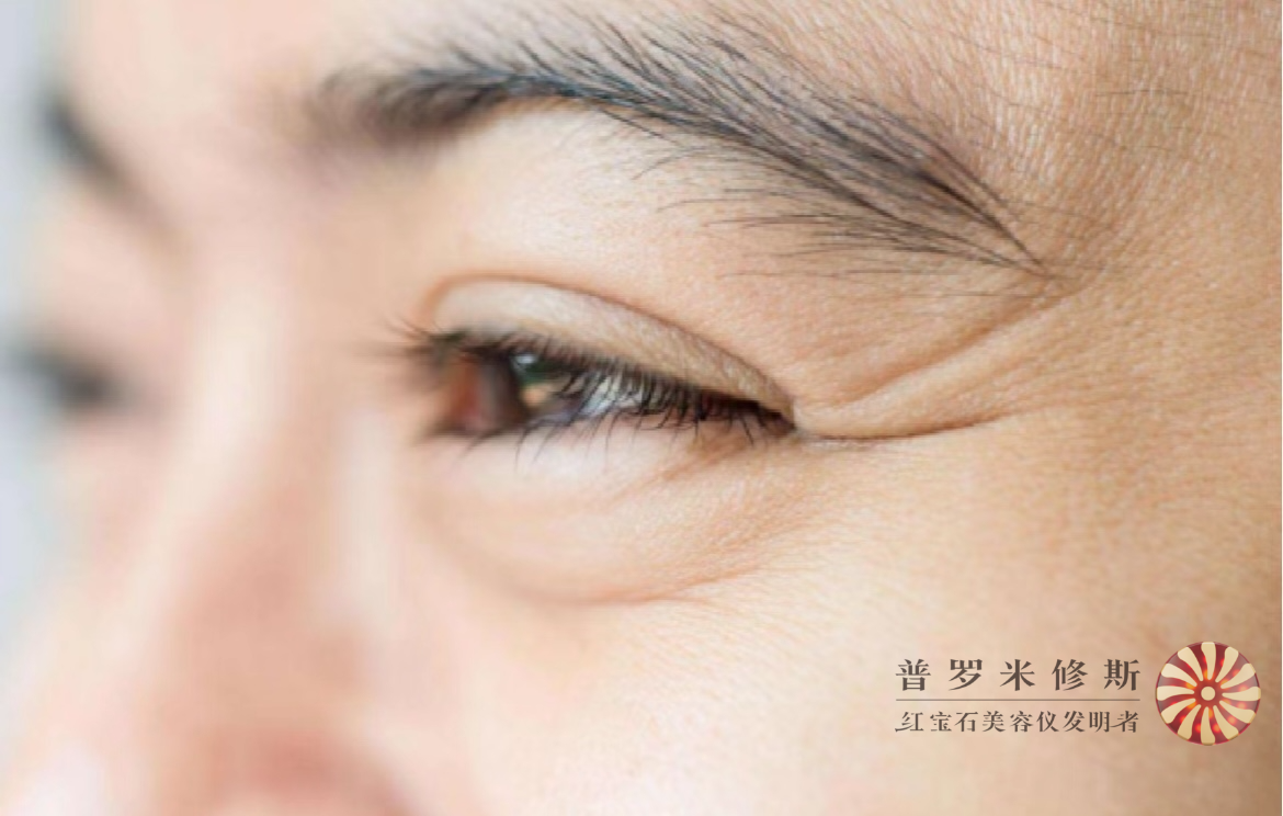 烙鐵們，你的魚尾紋真的需要熨一下！