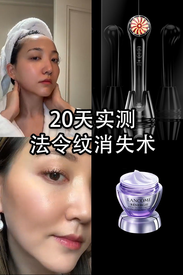 20天實(shí)測(cè)，法令紋消失術(shù)！射頻美容儀CP推薦