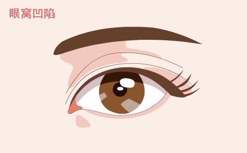 打造無痕肌膚，選擇激光祛痘印就是關(guān)鍵！