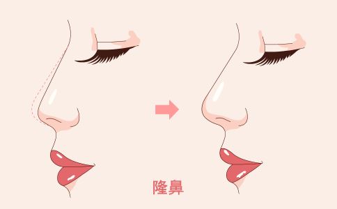 激光祛斑后的美麗攻略！遵循這些術(shù)后護(hù)理步驟，讓你的肌膚恢復(fù)如初！