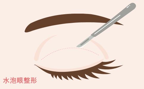 激光祛斑：了解原理，遵循術(shù)前術(shù)后要求，美麗肌膚輕松得！