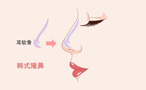 女性專屬：月經(jīng)周期影響激光祛斑效果，如何選擇最佳時間？