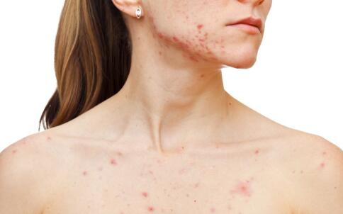 中藥?kù)疃慌浞接心男?你不知道的還有很多