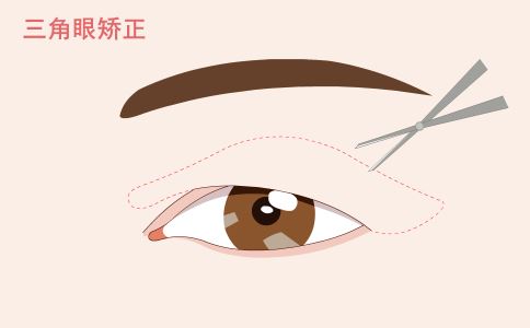 做面部拉皮除皺時(shí)應(yīng)注意什么?
